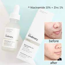 The Ordinary Niacinamide 10% + Zinc 1% High Strenth Vitamin And Mineral Blemish Formula 30ml